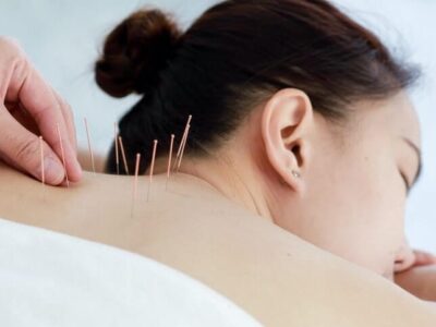 accupuncture-card-e1594663849813
